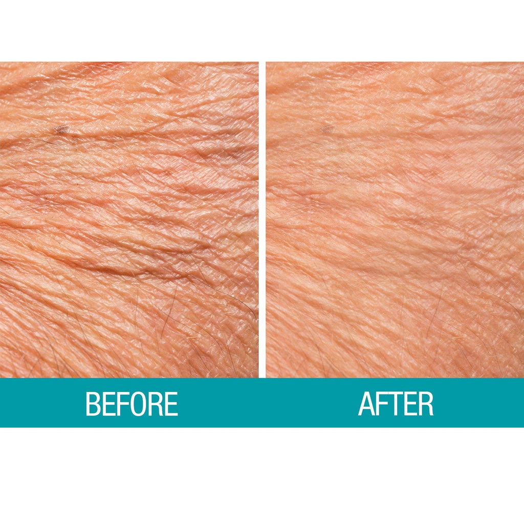Crepe Be Gone Body Repair Treatment Ultra Hydrating Skin Firming Cream - Large 12 ounce