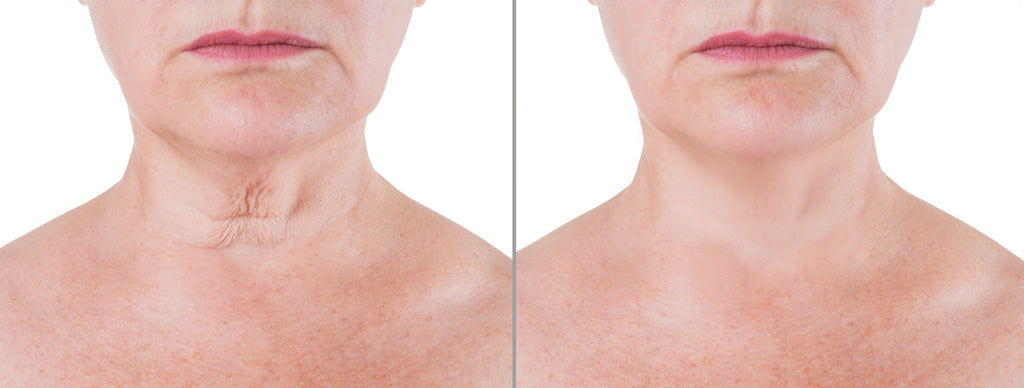 Dermactin Neck and Decolletage Smoothing Cream 1.5 oz.