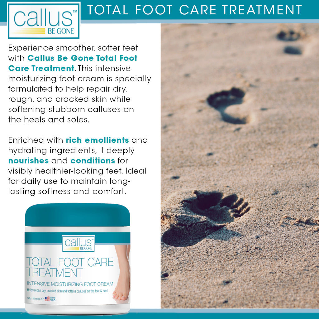 Callus Be Gone Total Foot Care Cream Treatment 12 Ounces