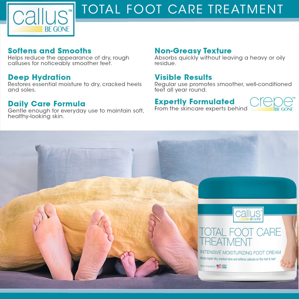 Callus Be Gone Total Foot Care Cream Treatment 12 Ounces